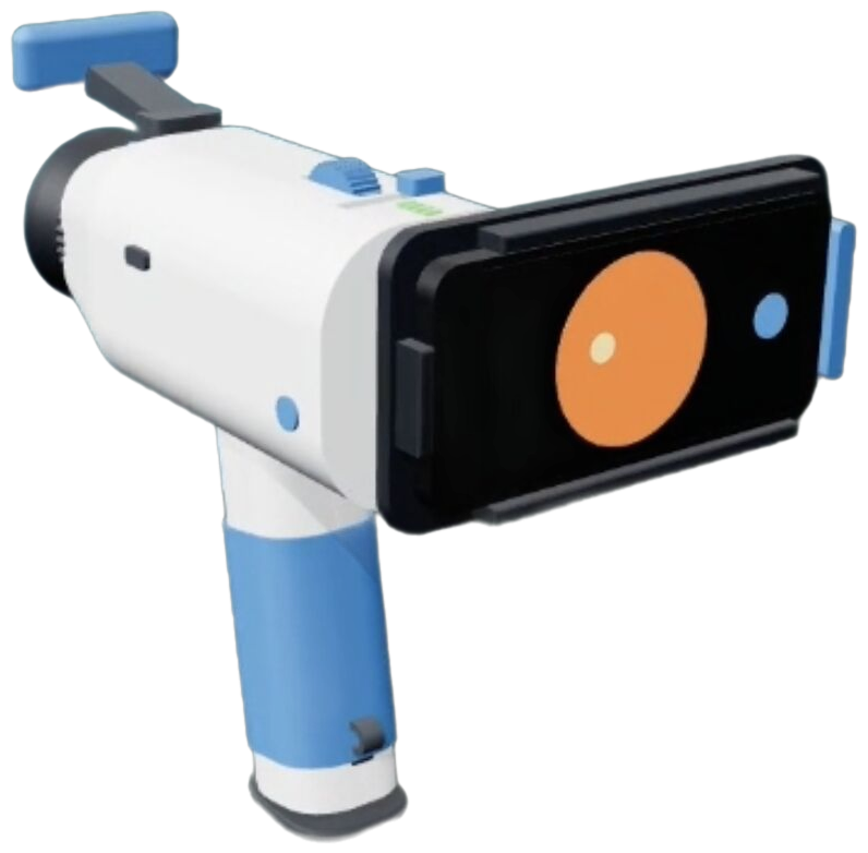 Ibsar Al-Ayn handheld retinal camera and AI web platform